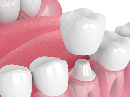 Morris Plains Center for Dentistry