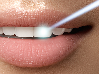 Morris Plains Center for Dentistry